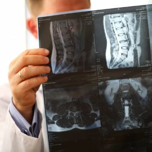Patologías de la columna vertebral Online - 90€