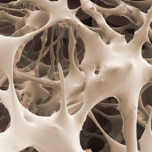 Prevención de la osteoporosis  - 120€ (Reserva 60€)