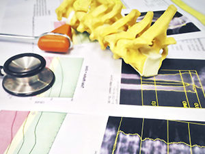 La Osteoporosis - 160€ (Reserva 60€)